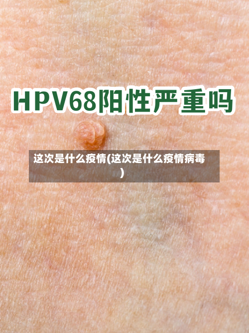 这次是什么疫情(这次是什么疫情病毒)