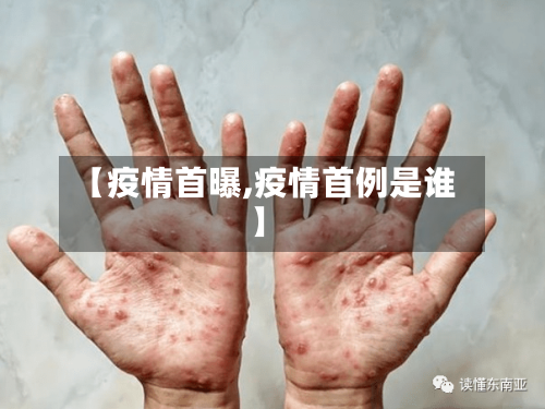 【疫情首曝,疫情首例是谁】